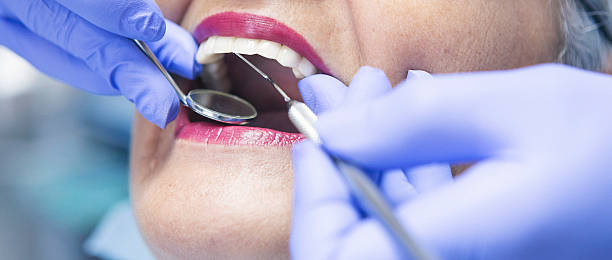 Best Dental Abscess Treatment in Dakota City, NE